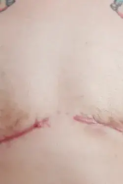 Boy with Bonus Hole's main photo 3